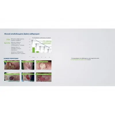 Urgoclean Ag  | Επίθεμα αργύρου για καθαρισμό πληγών