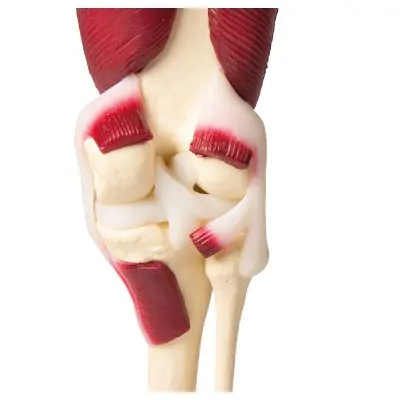 Knee Joint, life size, with muscles -Erler Zimmer