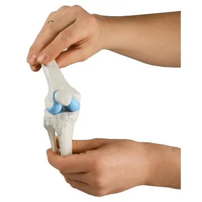 Μοντέλο Αρθροπλαστικής Γόνατος - Knee Implant Model