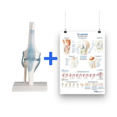 Super offer: Πρόπλασμα γόνατος + αφίσα γόνατος