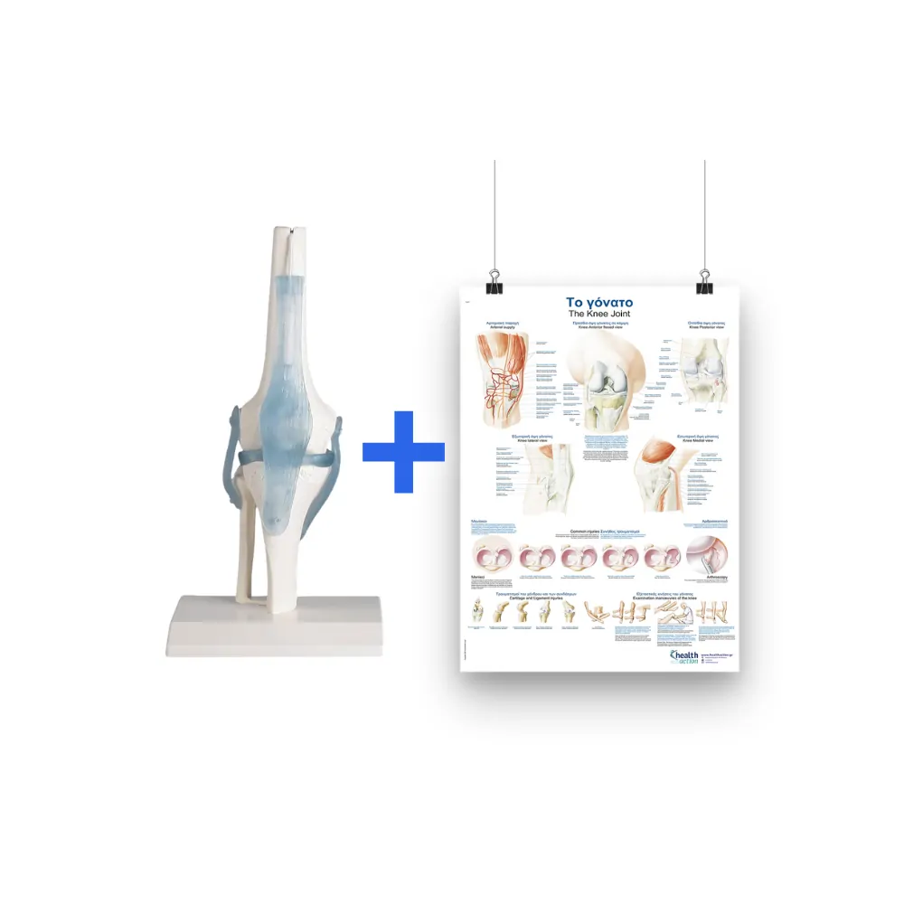 Super offer: Πρόπλασμα γόνατος + αφίσα γόνατος Super offer: Πρόπλασμα γόνατος + αφίσα γόνατος