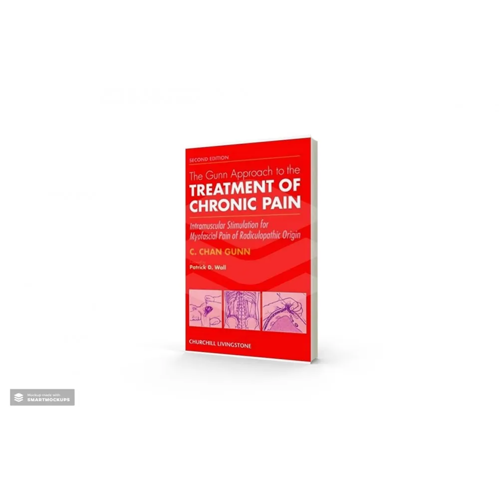 The Gunn Approach to the Treatment of Chronic Pain - C. Chan Gunn - 2nd edition The Gunn Approach to the Treatment of Chronic Pain - C. Chan Gunn - 2nd edition
