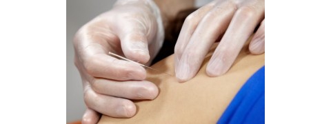 Dry needling ή Ξηρά βελόνα – Ποιές είναι οι επιδράσεις της ;