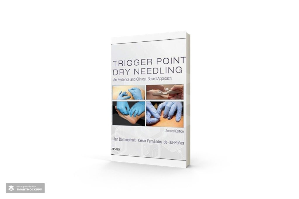 trigger point dry needling